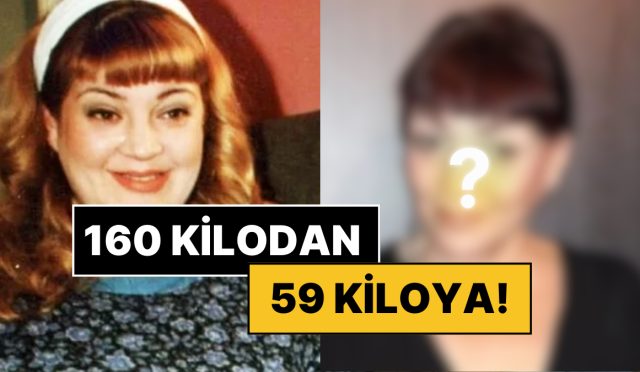 tam-101-kilo-verdi-baskul-ailesinin-fidani-gamze-gozalanin-degisimi-ve-yeni-meslegine-sasiracaksiniz-cZWzlRzz.jpg