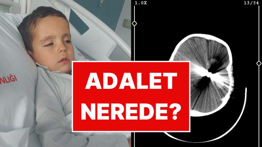 Yorgun Mermi 5 Yaşındaki Çocuğun Hayatını Kararttı: Gazeteci Emrullah Erdinç İsyan Etti