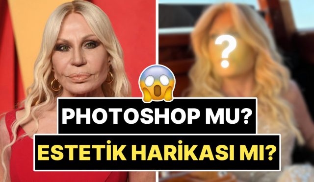 yuzundeki-dolgulari-eritip-kendini-bastan-yaratan-70-yasindaki-donatella-versacenin-son-hali-soka-soktu-BFRmYOcS.jpg