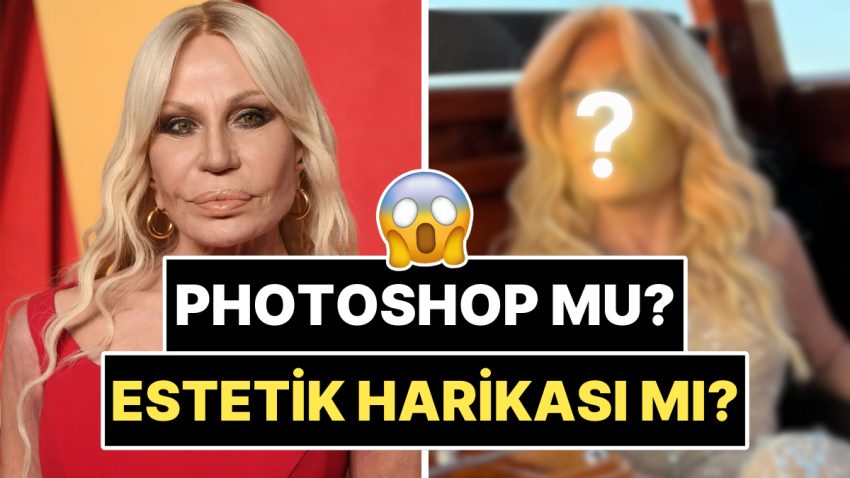 Yüzündeki Dolguları Eritip Kendini Baştan Yaratan 70 Yaşındaki Donatella Versace’nin Son Hali Şoka Soktu!